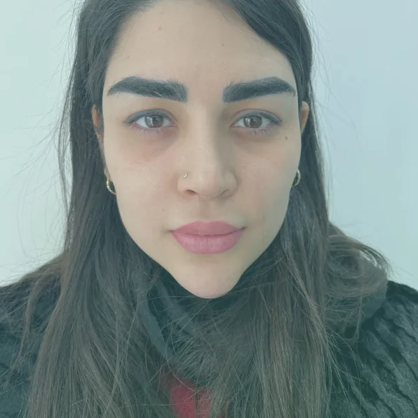 Blepharoplasty before and after results in Turkey at Dr. Sohrabi Clinic