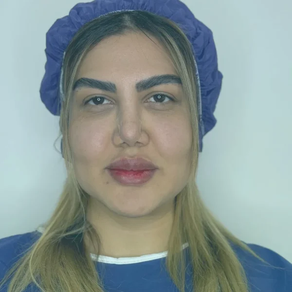 Blepharoplasty before and after results in Turkey at Dr. Sohrabi Clinic