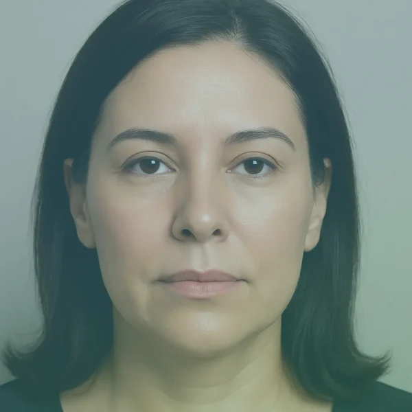 Botox Injection before and after results in Turkey at Dr. Sohrabi Clinic