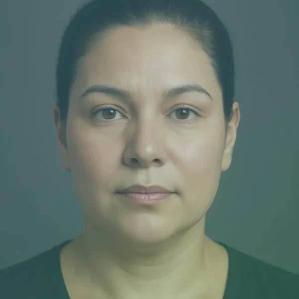 yag enjeksiyonu önce sonrası Türkiye