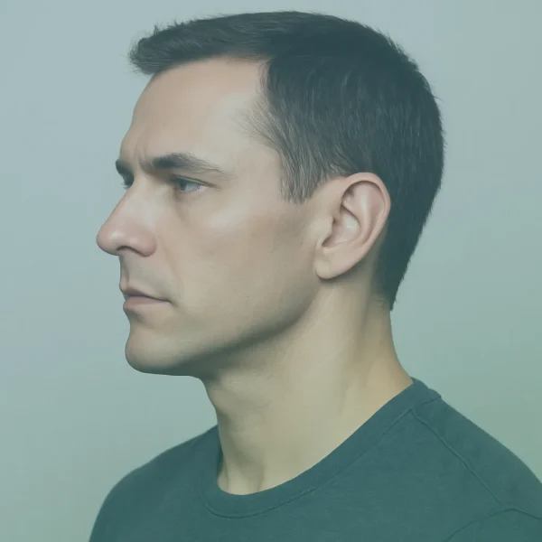 Double Chin Liposuction before and after results in Turkey at Dr. Sohrabi Clinic