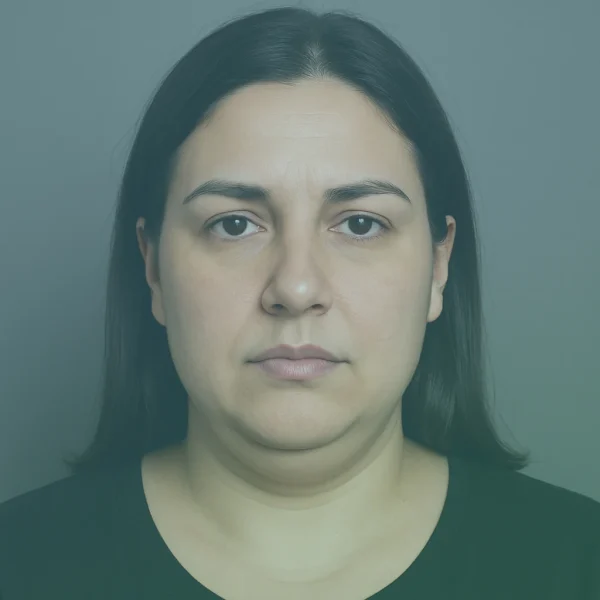 Double Chin Liposuction before and after results in Turkey at Dr. Sohrabi Clinic